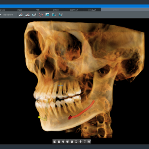 Pax i 3D Green X 16
