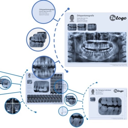 Software DentaSpace