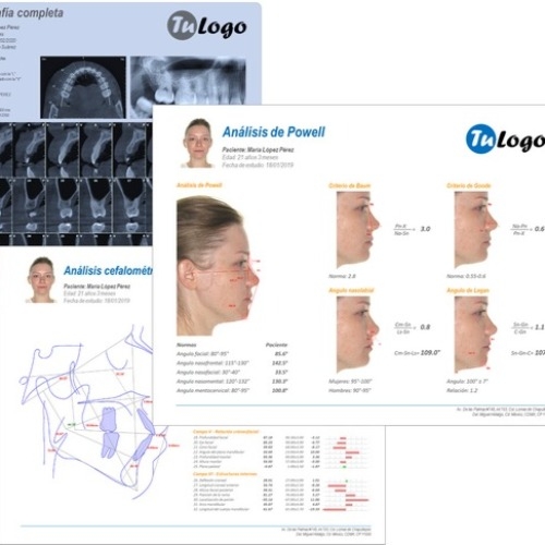 Software DentaSpace