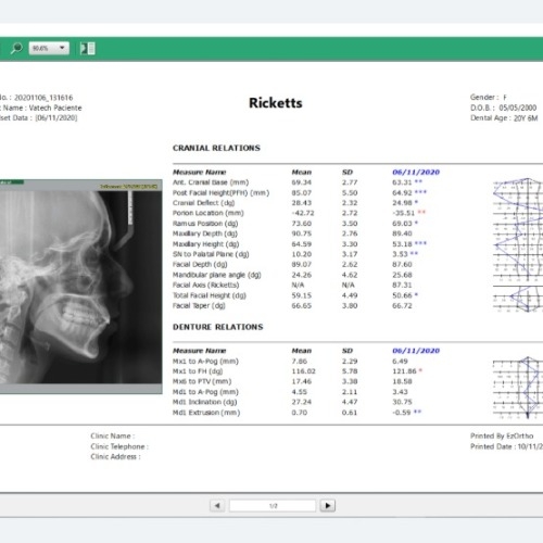 Software Trazado Cephalometrico EzOrtho Vatech