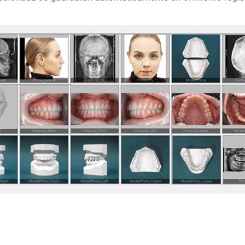 Software Trazado Cephalometrico EzOrtho Vatech