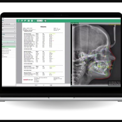 Software Trazado Cephalometrico EzOrtho Vatech