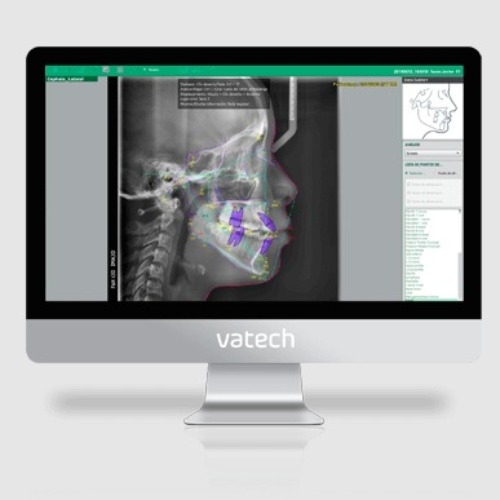 Software Trazado Cephalometrico EzOrtho Vatech