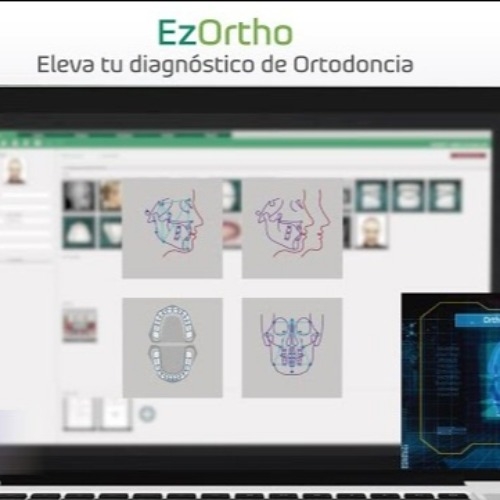 Software Trazado Cephalometrico EzOrtho Vatech