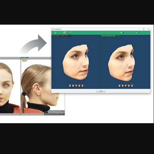 Software Trazado Cephalometrico EzOrtho Vatech